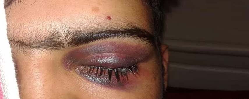 In Kashmir, The Young Are Paying   For India’s Lack of Vision